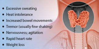 hyperthyroidism - symptoms