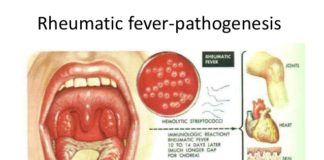 rheumatic fever