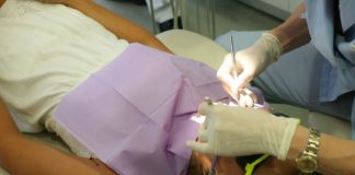 root canal