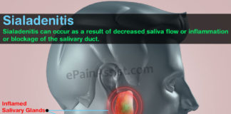 sialadenitis