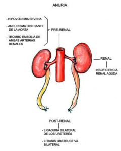 Anuria | Current Health Advice, Health Blog Articles and Tips