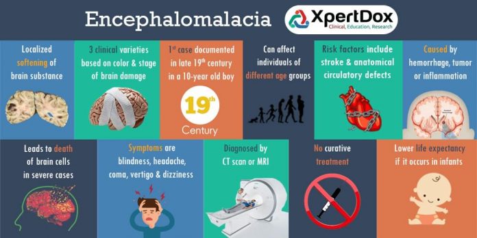 Encephalomalacia
